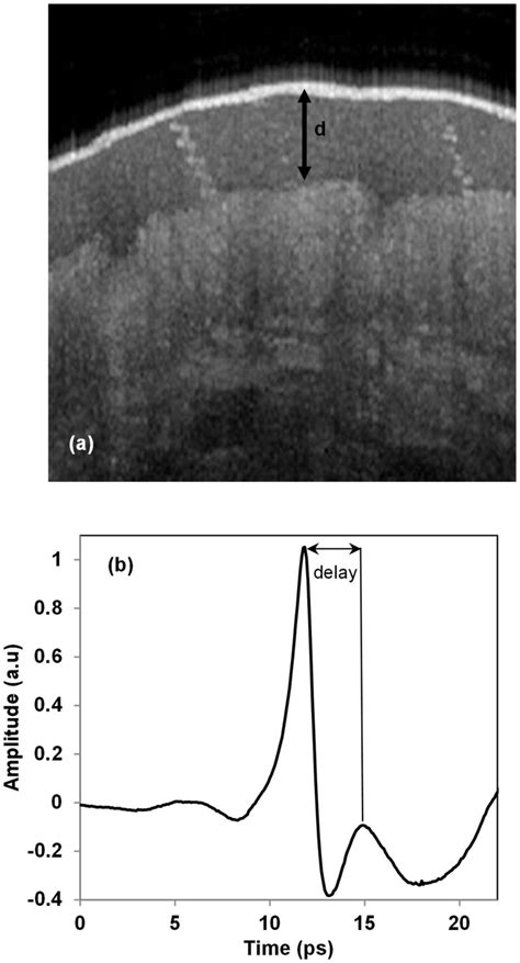 measurement of stratum corneum thickness|stratum corneum under microscope.